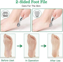 ZINGER Stainless Steel Corn cutter Dead Hard Skin Remover