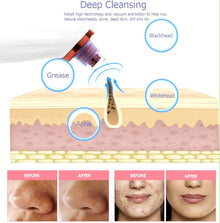 BLACKHEAD REMOVER PORE VACUUM CLEANER
