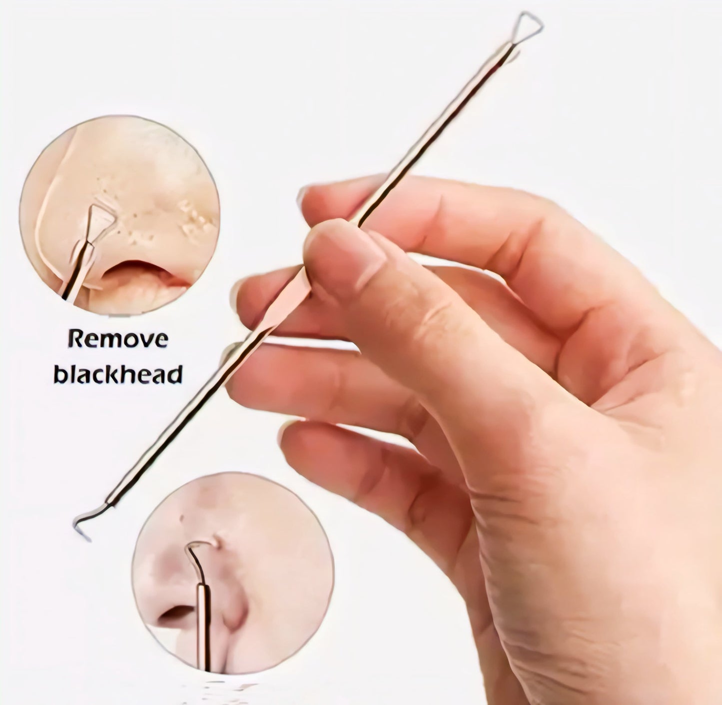Blackhead Whitehead Remover Tool