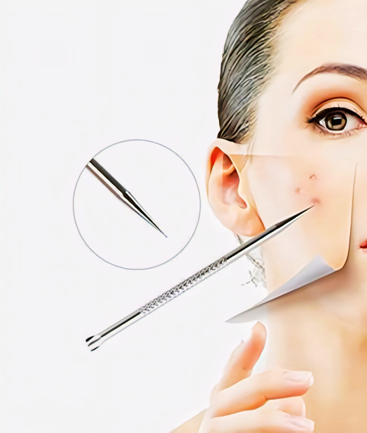 Stainless Steel Blackhead Remover Needle  (Pack of 1)