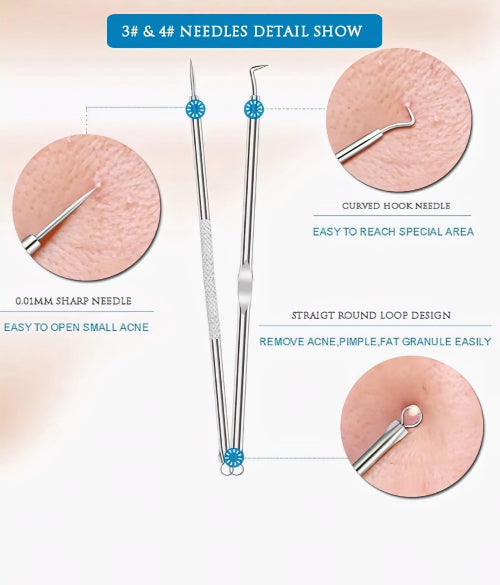 Blackhead Whitehead Remover Tool