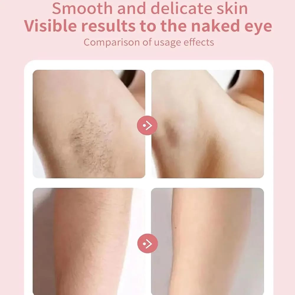 RECHARGEABLE EPILATOR FOR WOMEN FACE & BODY