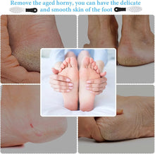 ZINGER DUAL SIDED FOOT FILE REMOVER