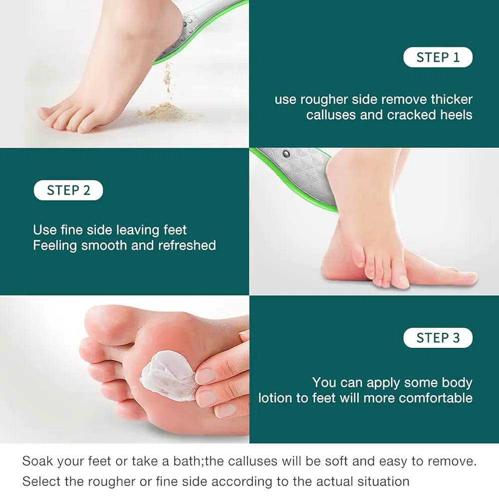 ZINGER Foot File Double Sided Callus Remover For Dead Skin