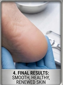 Foot Care Pedicure Callus Shaver Hard Skin Remover Foot Razor