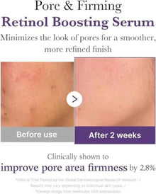 Medicube Retinol NMN Boosting Serum (30ml)